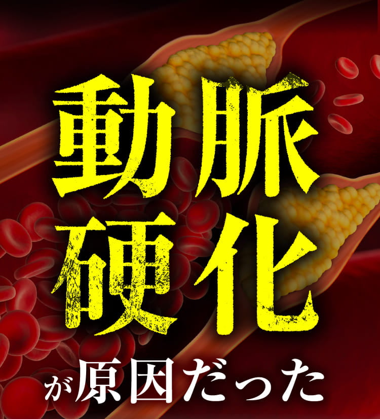 生活習慣などで動脈硬化になる人が多い